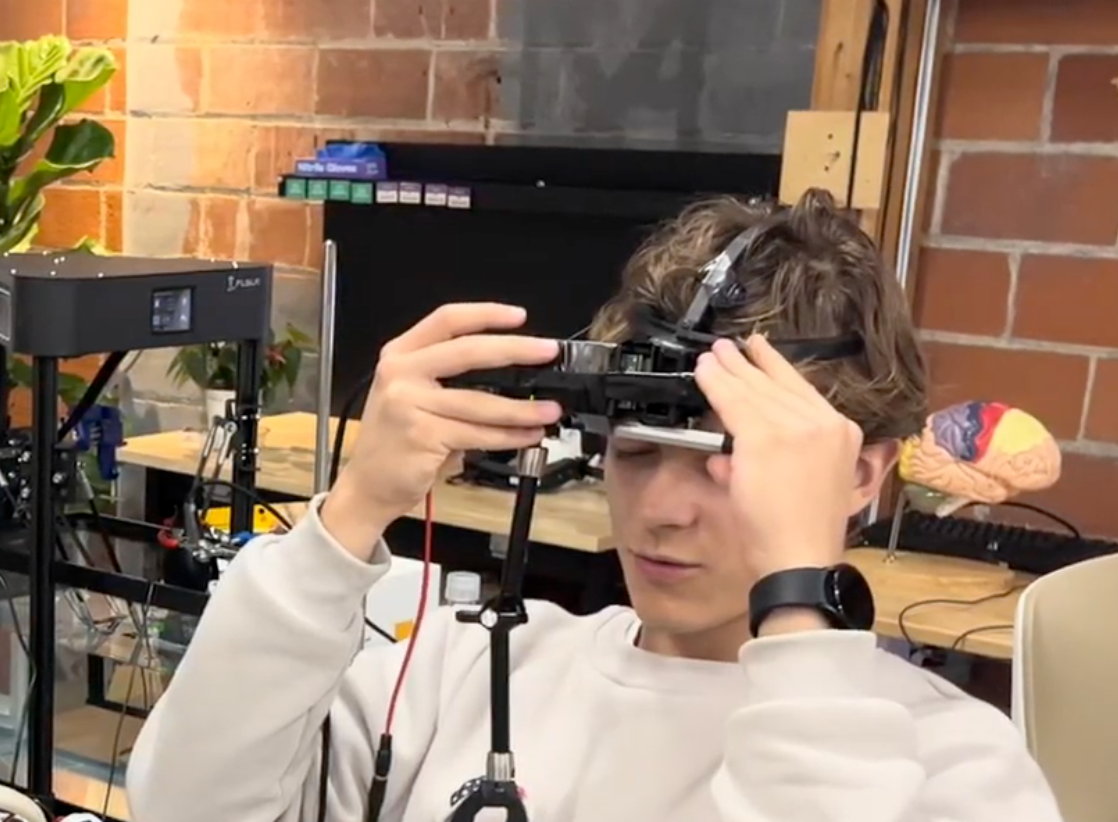 Ultrasound targeting diagram